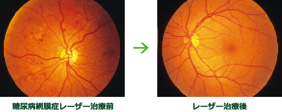 眼科レーザー治療のすべて (眼科診療プラクティス特大号) 神奈川で様々なレーザー装置を完備している眼科│大船田園眼科